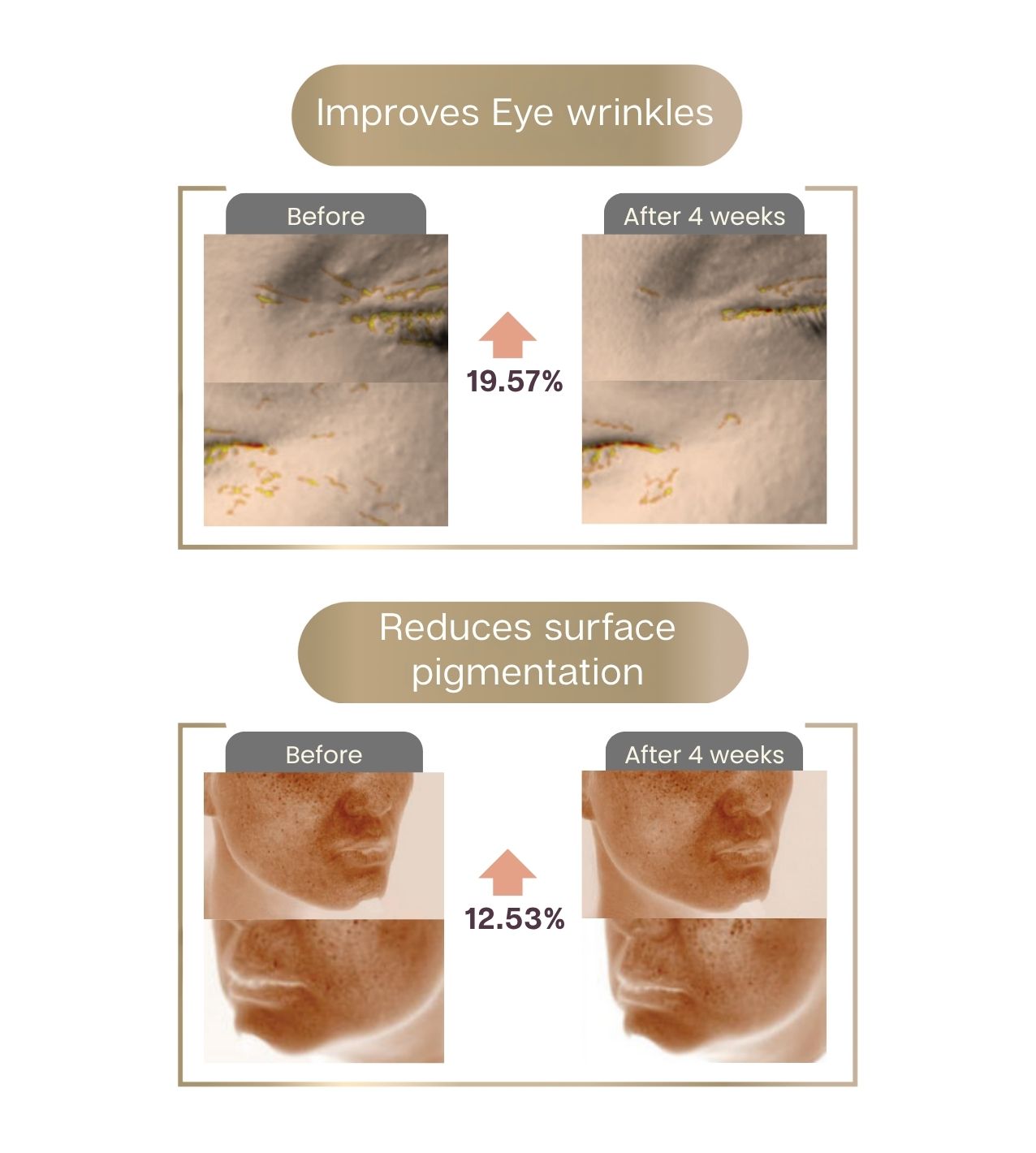 Complete Programmable Ampule Set