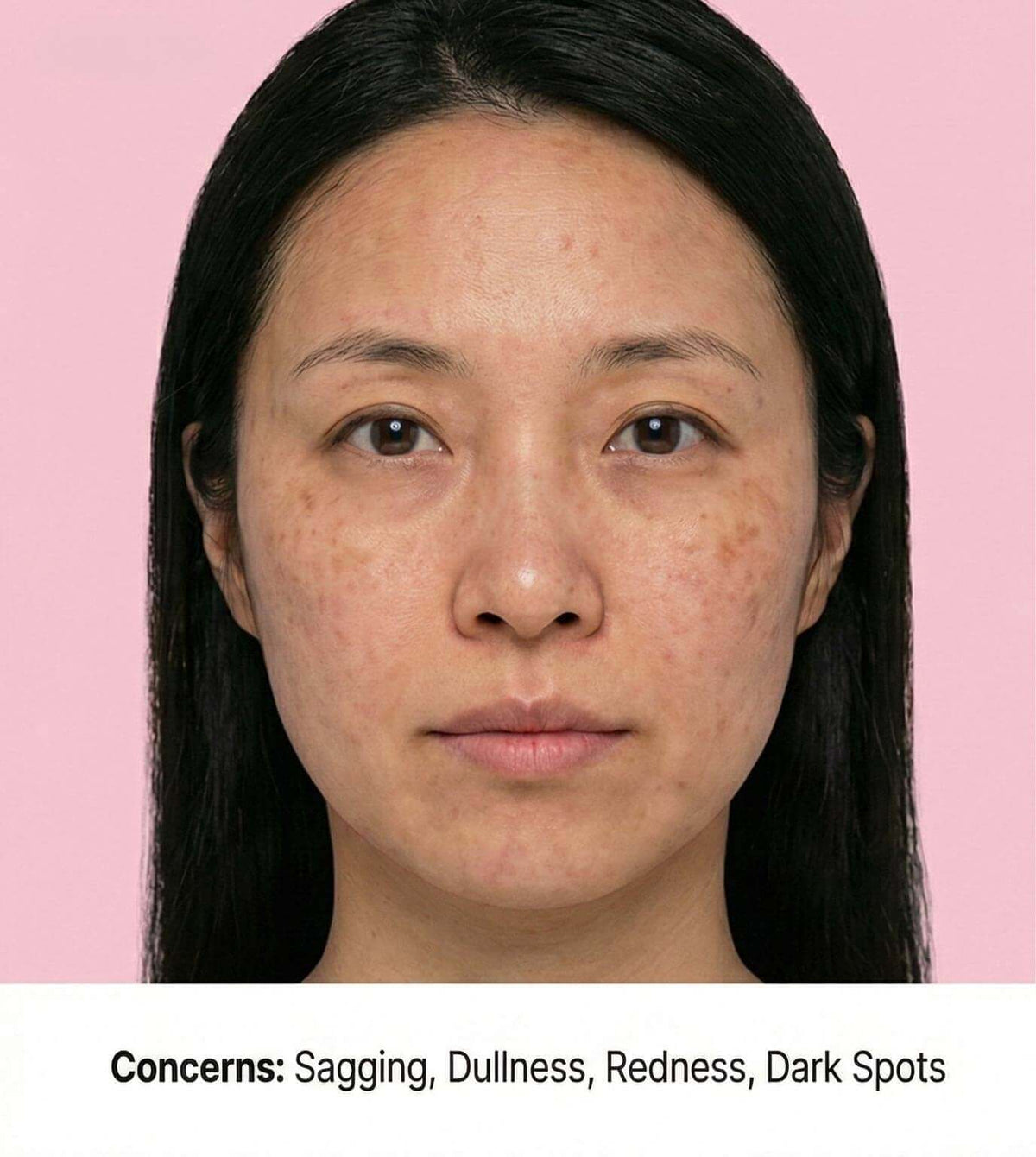 Before Skin Treatment